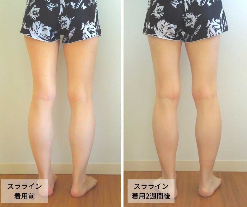 スラライン着用前と着用2週間の体型を比較